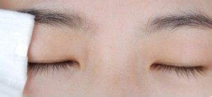 怎么贴好双眼皮贴