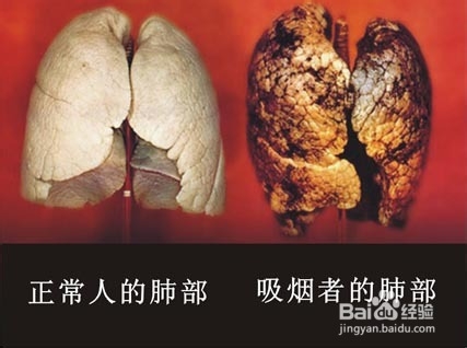 戒烟就这么简单