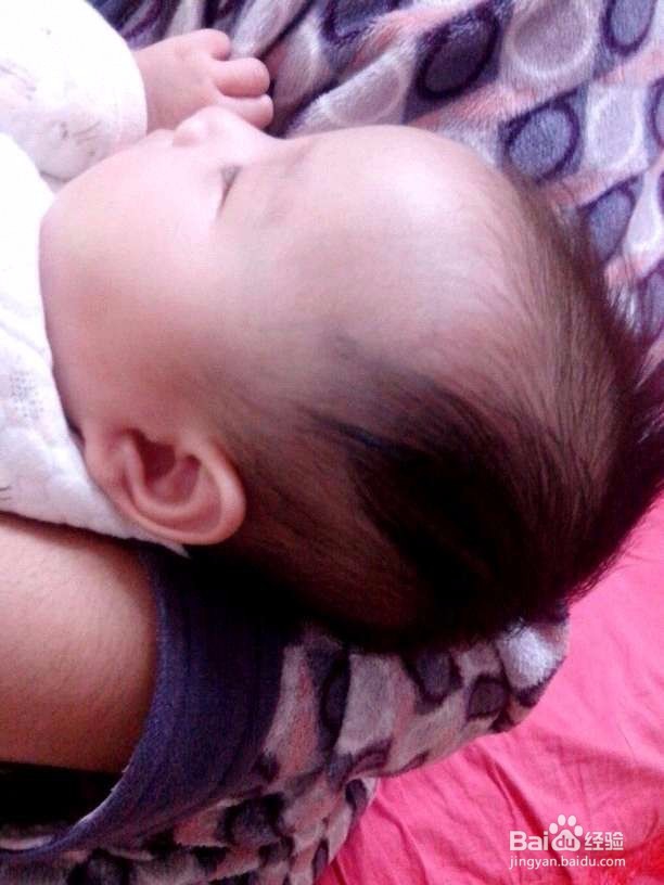 宝宝偏头丑掉渣,漂亮妈妈有妙方