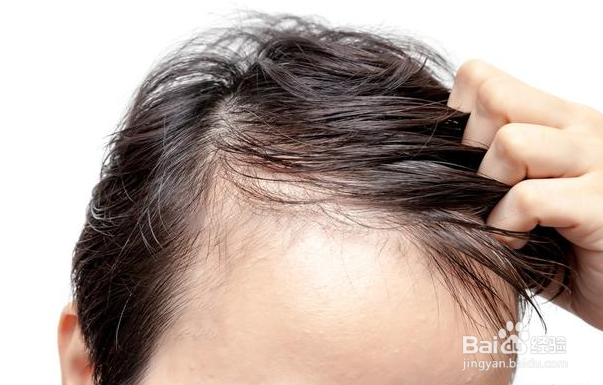 白发是怎样引起的,出现白发的原因有哪些 ?