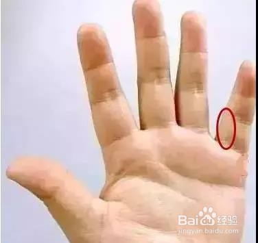 捏捏手指预防7大疾病