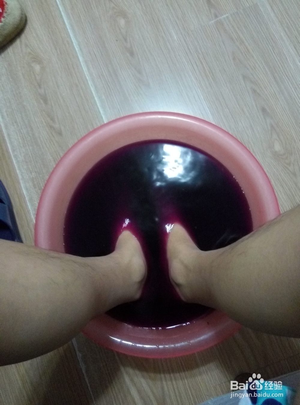 自己用高锰酸钾治疗脚气病经验分享