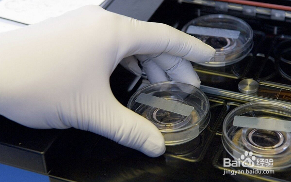 多囊卵巢综合征会影响到试管婴儿治疗吗？