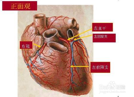 哪些冠心病患者需要介入治疗