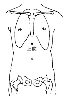 百病拔罐：[18]眩晕的拔罐疗法