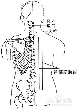 百病刮痧：[25]中暑的刮痧疗法