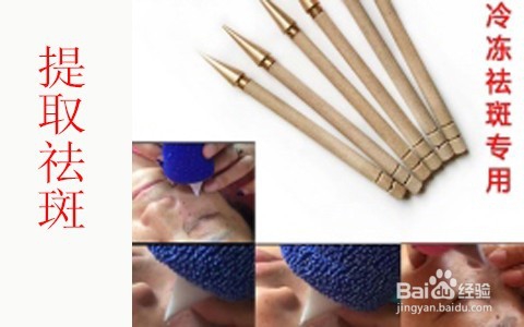 哺乳期能祛斑吗/吃奶时可以去雀斑吗