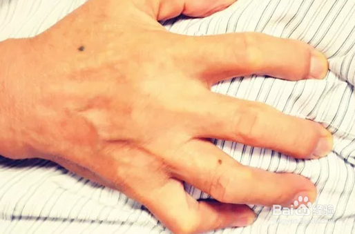 总是感觉肩膀疼 是怎么回事