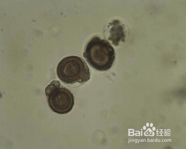 猫有绦虫家里怎么消毒