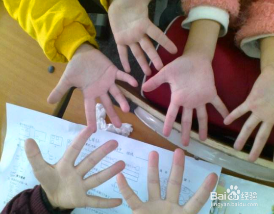 菌群失调怎么办