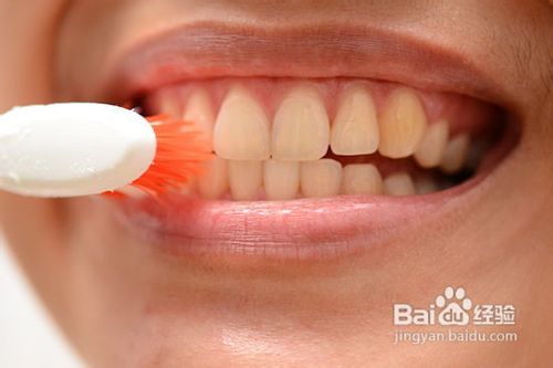 如何获得完美的牙齿