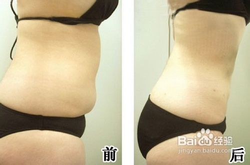 女人最有效的减肥方法