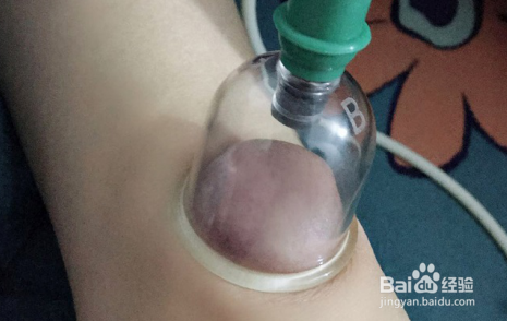 湿热体质太头疼：自然兰祛湿心得总结