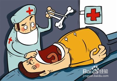 孩子发生异物卡喉该怎么办