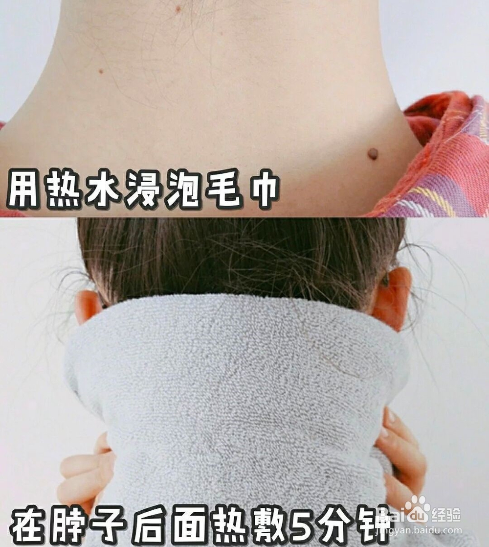 脖子黑怎么变白