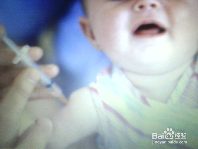 宝宝灼伤/烫伤，该怎么办？