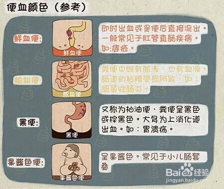 便血的原因有哪些