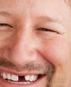 造成牙不齐的原因