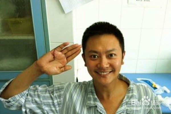 发生意外后,怎样急救?