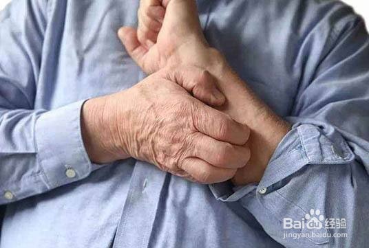 如何分辨湿疹和癣