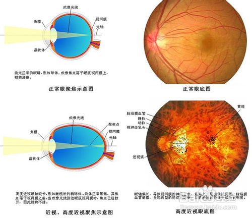 怎么选择自己合适的眼镜
