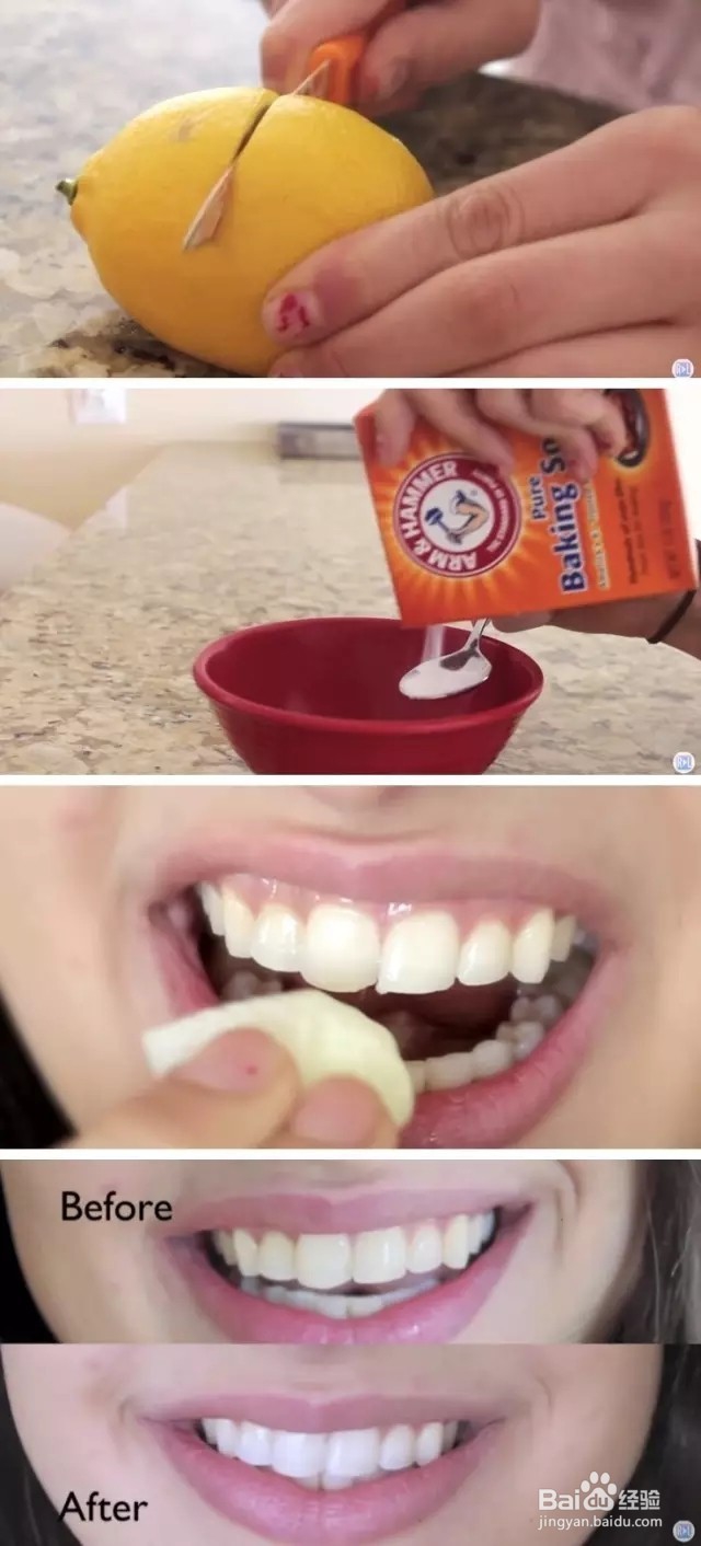 牙齿发黄怎么办
