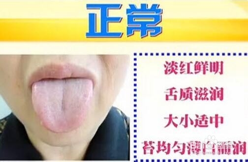 怎样改变我们的湿寒体质？