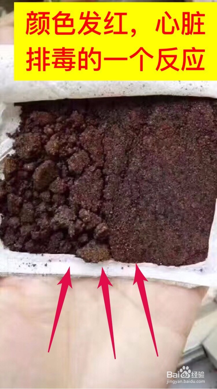 艾热灸使用后药包颜色对比
