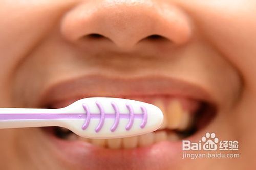 如何获得完美的牙齿