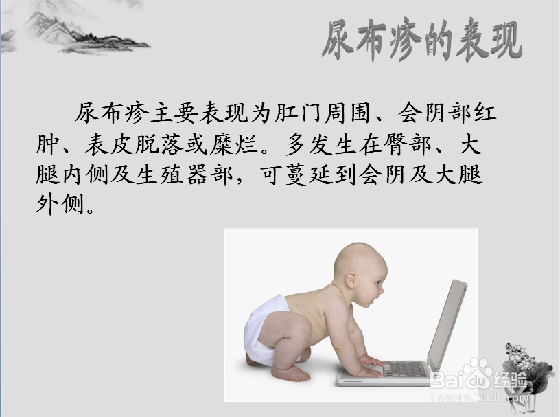 尿布疹怎么办