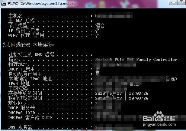 如何查看电脑计算机的网络参数？
