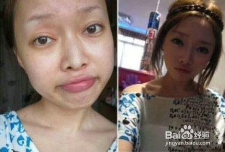天然美女养成记 秦宏伟整形让你无妆胜有妆