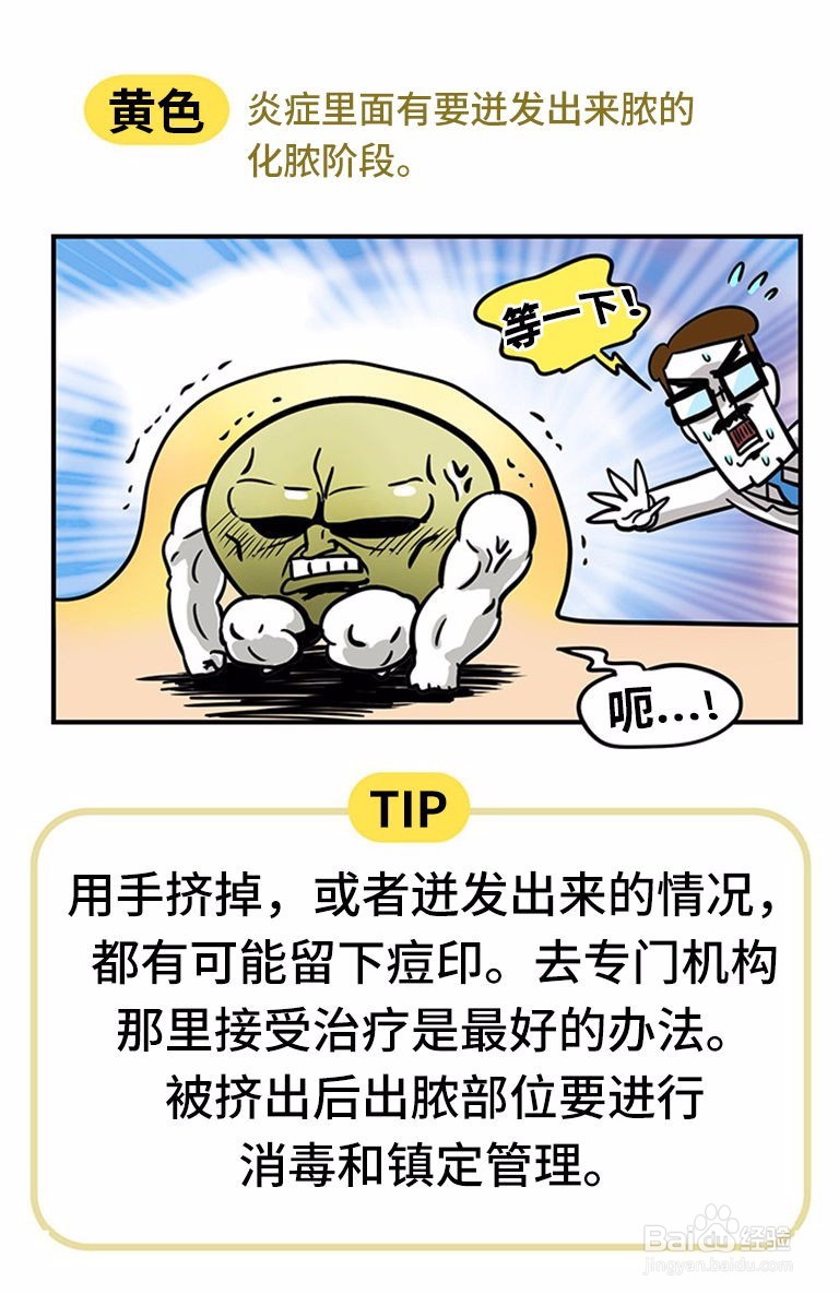长痘痘的原因有哪些