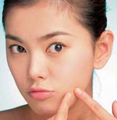 得了痤疮时要注意哪些