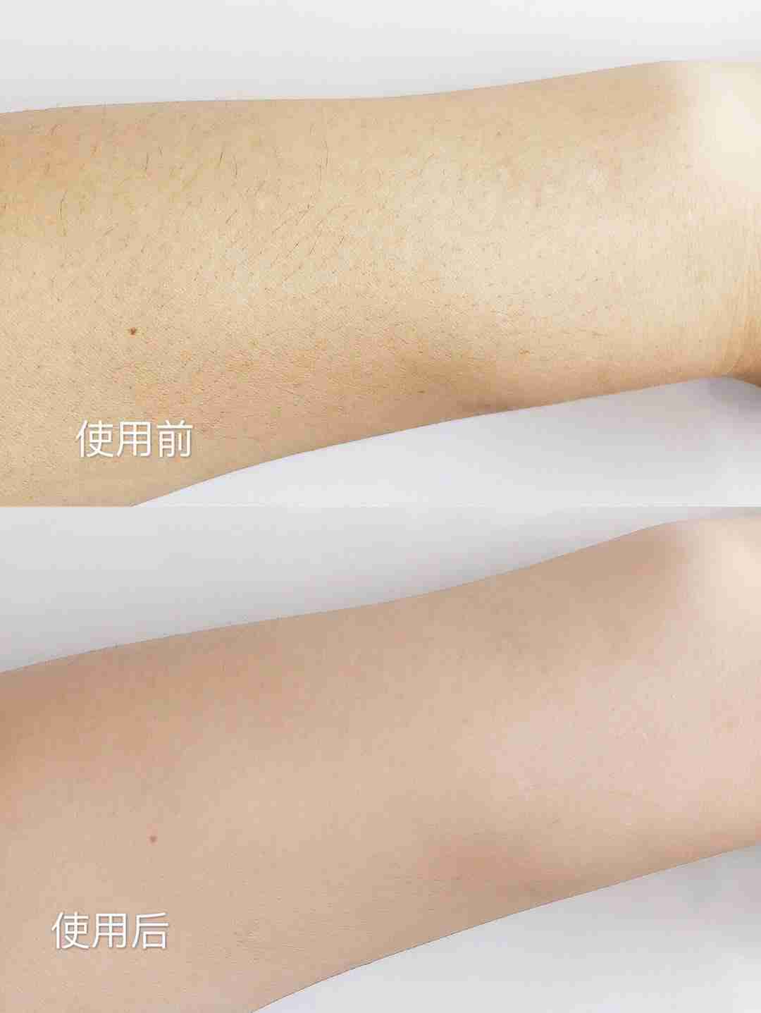 小仙女都在用它——博朗AI小闪电脱毛仪