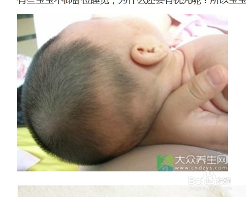 宝宝出现枕秃是怎么回事