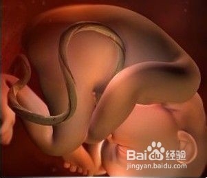 胎位不正一定不能顺产吗