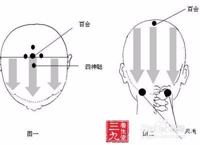 头部刮痧的步骤