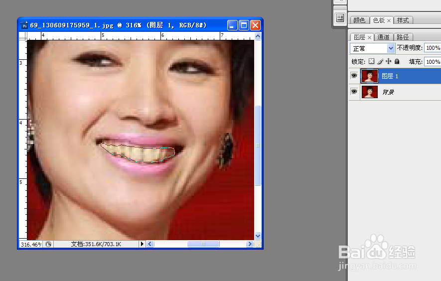 怎么将牙齿变得美白无暇