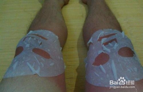 皮肤晒伤后如何治疗？