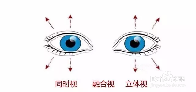 孩子两眼视力都恢复到正常就等于弱视治愈了?