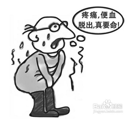 怎么治疗痔疮不复发