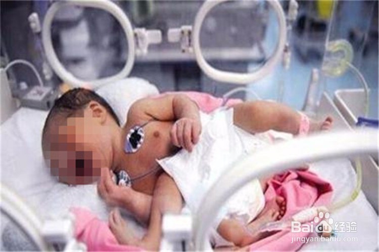新生儿死亡怎么办