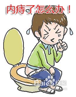 内痔需要手术吗