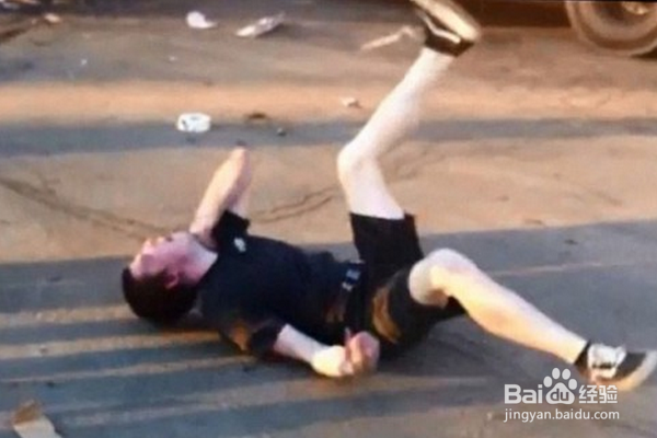 癫痫病怎么治疗