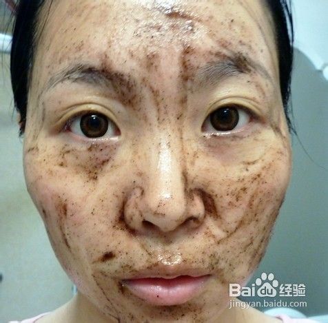 脸上斑点怎么去除