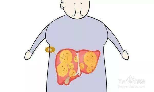 吃无花果有哪些功效又有哪些注意事项