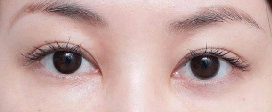 这样擦眼霜赶走眼角纹!