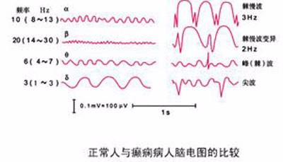 儿童抽动症和癫痫有什么区别