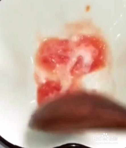 去除牙上的烟渍有什么小妙招？